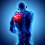 AC joint injuries