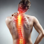 Dorsal Root Ganglion Therapy