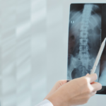 xray of spine facet joint injections