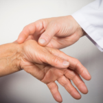 Therapy to help manage arthritis pain in hand