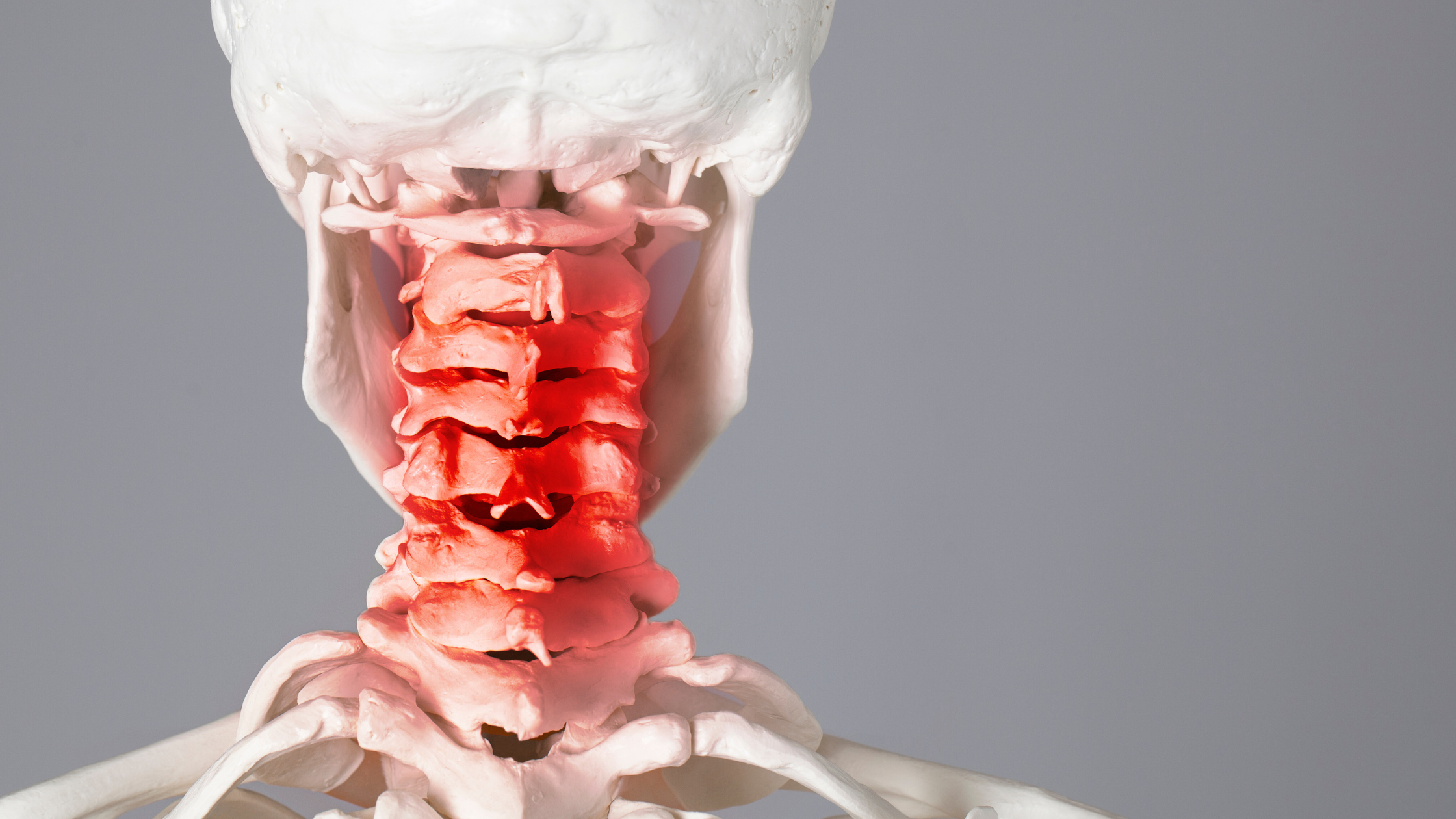 cervical neck pain