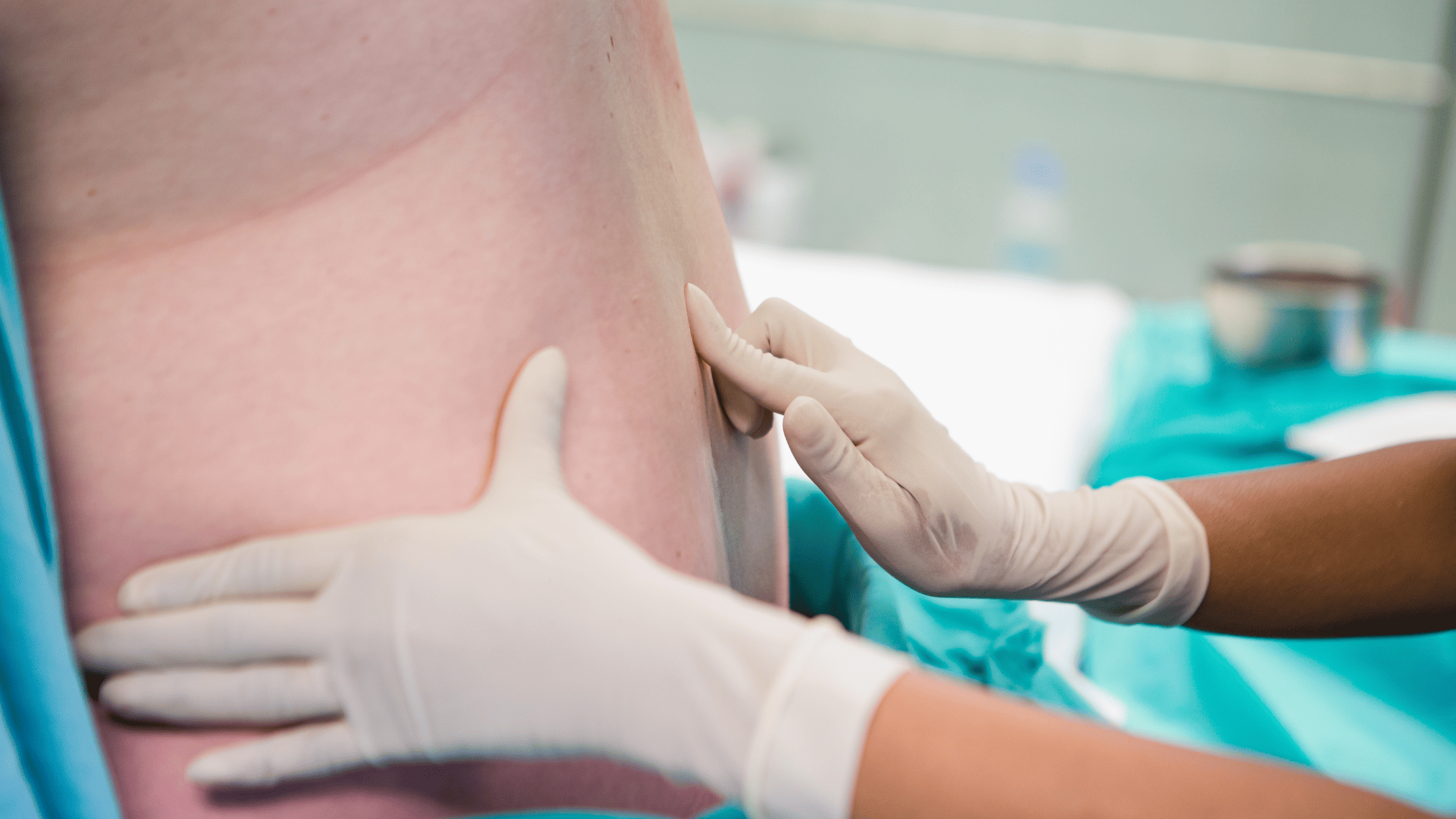 epidural steroid injections