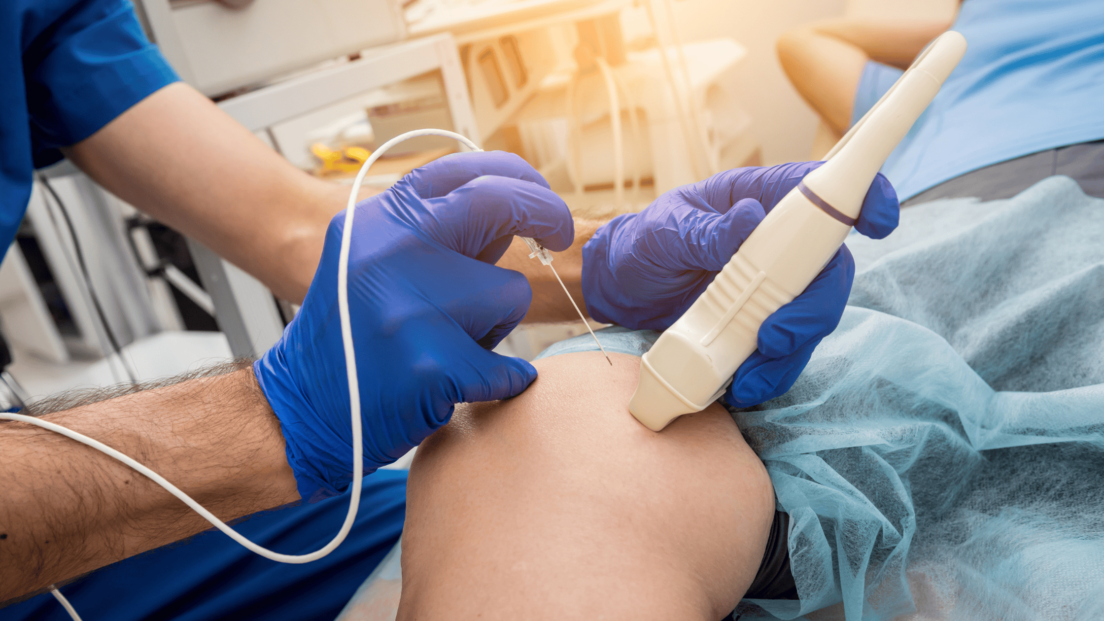 radiofrequency ablation