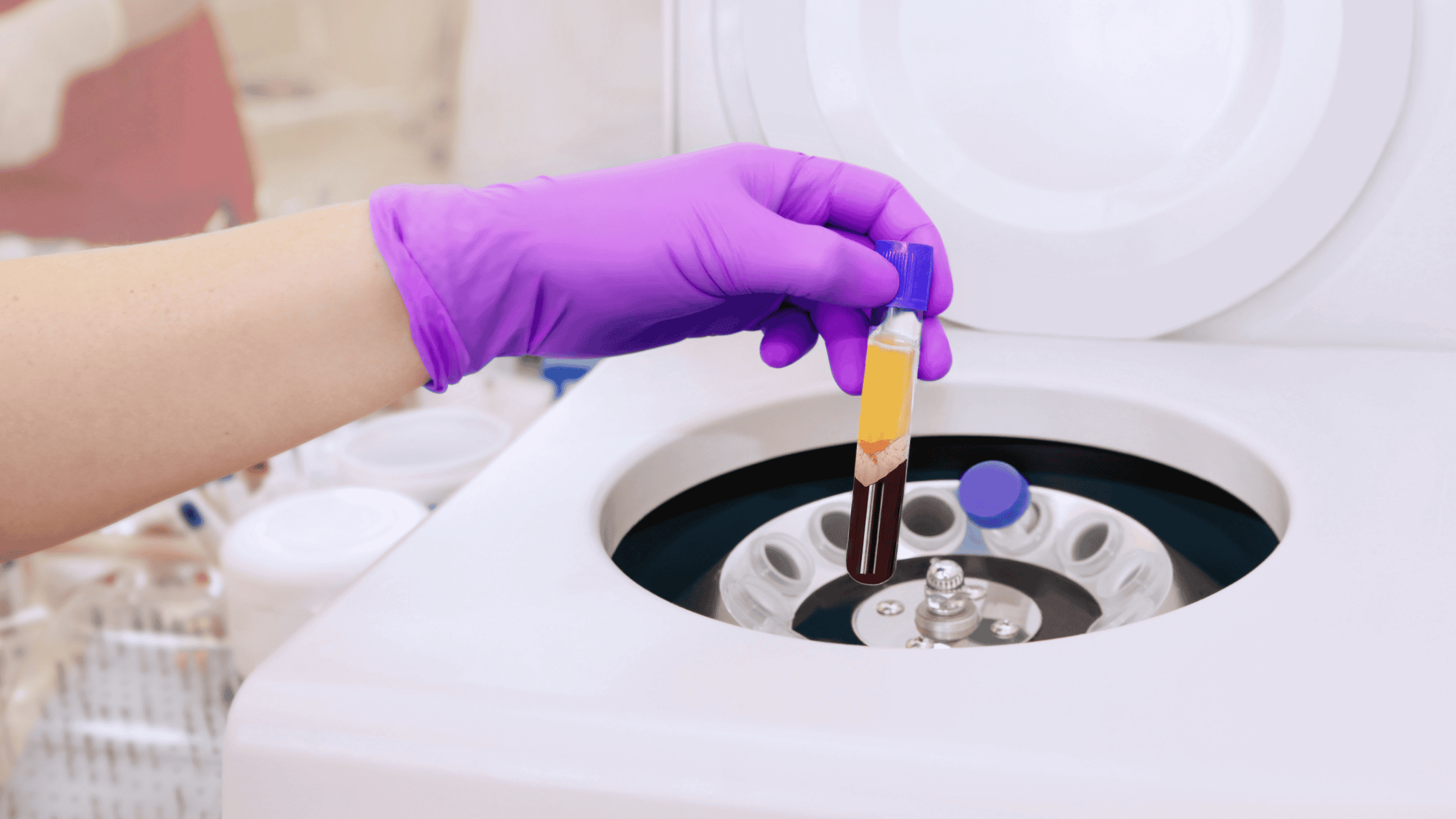 PRP therapy for chronic pain management
